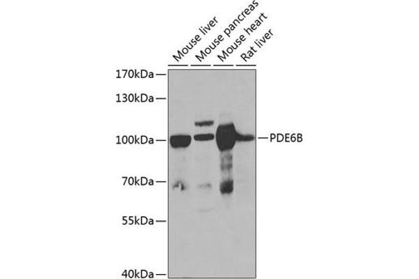 PDE6B anticorps  (AA 1-190)