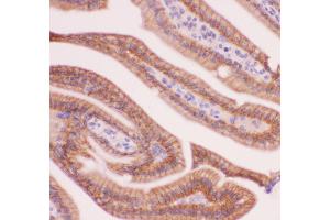 Immunohistochemistry (IHC) image for anti-Catenin (Cadherin-Associated Protein), alpha 1, 102kDa (CTNNA1) (AA 143-292) antibody (ABIN3043818)