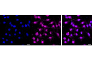 Immunocytochemical staining of HeLa cells with Nucleoporin 107 antibody (ABIN7799674), 1:1,000).