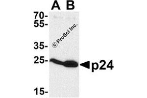 Western Blotting (WB) image for anti-Human Immunodeficiency Virus 1 Capsid (HIV-1 p24) antibody (ABIN1077455) (HIV-1 p24 抗体)