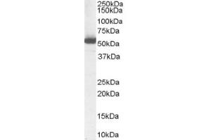 Image no. 1 for anti-Aldehyde Dehydrogenase 1 Family, Member A1 (ALDH1A1) (Internal Region) antibody (ABIN374658) (ALDH1A1 抗体  (Internal Region))