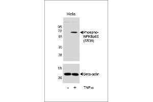 Western blot analysis of lysates from Hela cell line, untreated or treated with TNF-α, 20 ng/mL, using Phospho-NFKBp65 Antibody  (upper) or Beta-actin (lower). (NFkB 抗体  (pSer536))