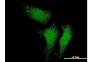 Immunofluorescence of monoclonal antibody to RUVBL1 on HeLa cell. (RUVBL1 抗体  (AA 1-456))