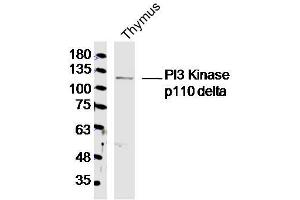 Mouse Thymus lysates probed with PI3 Kinase p110 delta Polyclonal Antibody, Unconjugated  at 1:300 dilution and 4˚C overnight incubation.