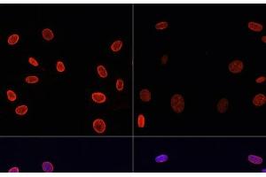Immunofluorescence analysis of NIH/3T3 cells using Acetyl-Histone H4-K91 Polyclonal Antibody at dilution of 1:100. (Histone H4 抗体  (acLys91))
