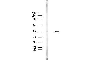 anti-Dyslexia Susceptibility 1 Candidate 1 (DYX1C1) (Internal Region) antibody
