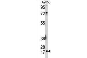 Western Blotting (WB) image for anti-Ubiquitin-Conjugating Enzyme E2I (UBE2I) antibody (ABIN2995752)