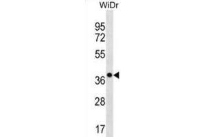Western Blotting (WB) image for anti-Chloride Channel Accessory 3, Pseudogene (CLCA3P) antibody (ABIN3000478) (CLCA3P 抗体)