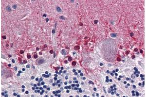 Human Brain, Cerebellum: Formalin-Fixed, Paraffin-Embedded (FFPE) (CBS 抗体  (AA 1-101))