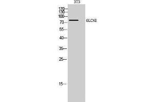 Western Blotting (WB) image for anti-Glucosamine (UDP-N-Acetyl)-2-Epimerase/N-Acetylmannosamine Kinase (GNE) (C-Term) antibody (ABIN3184799) (GNE 抗体  (C-Term))