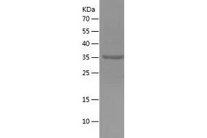 Western Blotting (WB) image for Myosin, Light Chain 1, Alkali, Skeletal, Fast (MYL1) (AA 1-150) protein (His-IF2DI Tag) (ABIN7282500) (MYL1 Protein (AA 1-150) (His-IF2DI Tag))