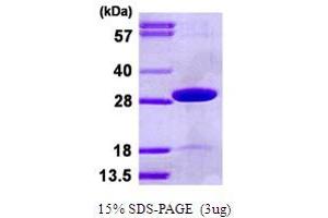SDS-PAGE (SDS) image for Thiamin Pyrophosphokinase 1 (TPK1) (AA 1-243) protein (His tag) (ABIN667678) (TPK1 Protein (AA 1-243) (His tag))
