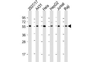 All lanes : Anti-alpha Tubulin Antibody at 1:2000 dilution Lane 1: 293T/17 whole cell lysate Lane 2: A431 whole cell lysate Lane 3: Hela whole cell lysate Lane 4: HepG2 whole cell lysate Lane 5: Jurkat whole cell lysate Lane 6: Raji whole cell lysate Lysates/proteins at 20 μg per lane. (alpha Tubulin 抗体  (AA 408-439))