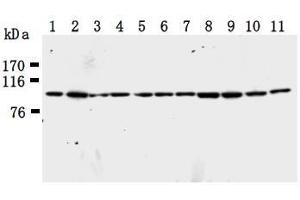 Western Blotting (WB) image for anti-Karyopherin (Importin) beta 1 (KPNB1) antibody (ABIN1449199) (KPNB1 抗体)