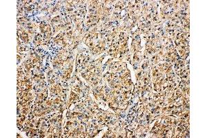 Immunohistochemistry (IHC) image for anti-serpin Peptidase Inhibitor, Clade A (Alpha-1 Antiproteinase, Antitrypsin), Member 4 (SERPINA4) (AA 384-401), (C-Term) antibody (ABIN3043135)