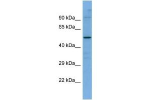 Host:  Rabbit  Target Name:  SLC5A7  Sample Type:  ACHN Whole Cell lysates  Antibody Dilution:  1. (ChT 抗体  (C-Term))
