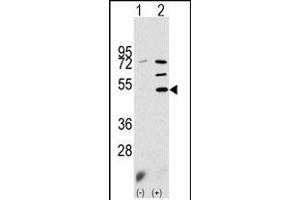 Western blot analysis of PDK3 (arrow) using rabbit polyclonal PDK3 Antibody (N-term) (ABIN391038 and ABIN2841204). (PDK3 抗体  (N-Term))