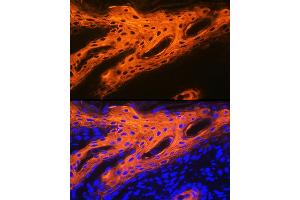 Immunofluorescence analysis of human skin using Cytokeratin 2e (KRT2) Rabbit mAb (ABIN1680763, ABIN3016322, ABIN3016323 and ABIN7101480) at dilution of 1:100 (40x lens). (Keratin 2 抗体)