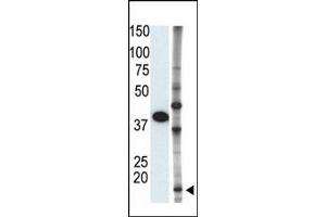 Image no. 1 for anti-Small Ubiquitin Related Modifier 2 (SUMO2) (C-Term) antibody (ABIN356794) (SUMO2 抗体  (C-Term))