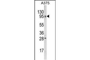 Western blot analysis of C6orf170 Antibody in A375 cell line lysates (35ug/lane)