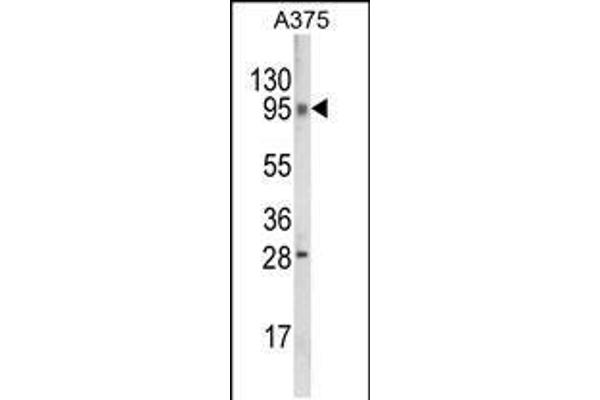 Chromosome 6 Open Reading Frame 170 (C6ORF170) (AA 112-139), (N-Term) antibody