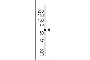 The anti-BACE2C C-term Pab (ABIN390057 and ABIN2837930) is used in Western blot to detect BACE2C in A549 cell lysate. (BACE2C 抗体  (C-Term))