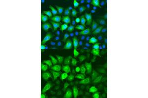 Immunofluorescence analysis of A549 cells using RRM2 antibody. (RRM2 抗体)