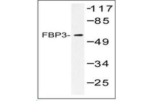 Image no. 2 for anti-Far Upstream Element (FUSE) Binding Protein 3 (FUBP3) antibody (ABIN317906) (FUBP3 抗体)