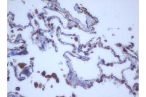 Image no. 6 for anti-DEAD (Asp-Glu-Ala-Asp) Box Polypeptide 59 (DDX59) (AA 1-303) antibody (ABIN1490728)