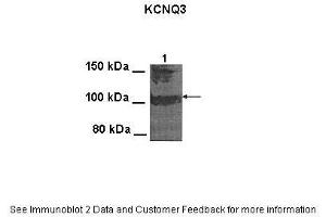 Lanes:   100 ug CHO cell lysate  Primary Antibody Dilution:   1:1000  Secondary Antibody:   Goat anti-rabbit HRP  Secondary Antibody Dilution:   1:25000  Gene Name:   Kcnq3  Submitted by:   Anonymous (KCNQ3 抗体  (Middle Region))