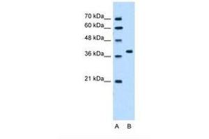Image no. 2 for anti-RUN Domain Containing 2A (RUNDC2A) (N-Term) antibody (ABIN321330) (SNX29 抗体  (N-Term))