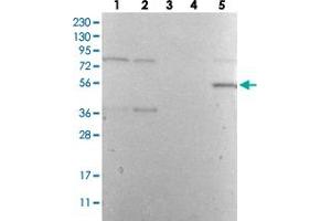 Western Blot analysis with DES polyclonal antibody  Lane 1: Human cell line RT-4 Lane 2: Human cell line U-251MG sp Lane 3: Human plasma (IgG/HSA depleted) Lane 4: Human liver tissue Lane 5: Human tonsil tissue