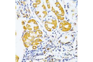 Immunohistochemistry of paraffin-embedded human stomach using MMP2 antibody (ABIN1882374) at dilution of 1:100 (40x lens). (MMP2 抗体)