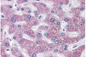 Immunohistochemistry (IHC) image for anti-Solute Carrier Family 5 (Sodium/inositol Cotransporter), Member 11 (SLC5A11) (Internal Region) antibody (ABIN1049343)