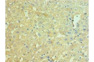 Immunohistochemistry of paraffin-embedded human liver tissue using ABIN7161572 at dilution of 1:100 (NAMPT 抗体  (AA 1-280))