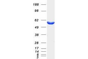 Western Blotting (WB) image for 6-phosphofructo-2-Kinase/fructose-2,6-Biphosphatase 4 (PFKFB4) protein (Myc-DYKDDDDK Tag) (ABIN2728751)