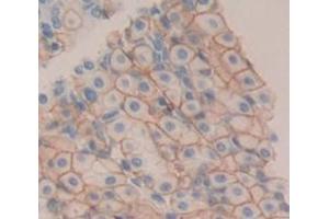 Used in DAB staining on fromalin fixed paraffin- embedded Kidney tissue (TREM2 抗体  (AA 1-228))