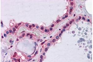Human Thyroid: Formalin-Fixed, Paraffin-Embedded (FFPE) (Hepcidin 抗体  (AA 25-85))