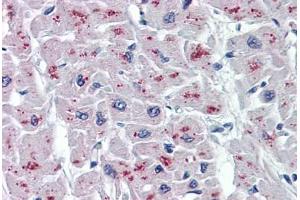 Human Heart: Formalin-Fixed, Paraffin-Embedded (FFPE) (ASAH1 抗体  (AA 25-125))