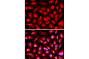 Immunofluorescence analysis of U2OS cells using ETS1 antibody.