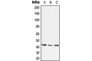 Western blot analysis of LMX1B expression in HeLa (A), Jurkat (B), SP2/0 (C) whole cell lysates. (LMX1B 抗体  (Center))