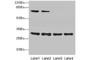 Western blot All lanes: SPIN3 antibody at 6 μg/mL Lane 1: A549 whole cell lysate Lane 2: Hela whole cell lysate Lane 3: A431 whole cell lysate Lane 4: HepG2 whole cell lysate Secondary Goat polyclonal to rabbit IgG at 1/10000 dilution Predicted band size: 30, 9 kDa Observed band size: 30, 70 kDa (SPIN3 抗体  (AA 1-77))