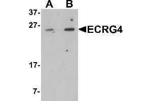 Western blot analysis of ECRG4 in HeLa cell lysate with ECRG4 antibody at (A) 1 and (B) 2 µg/mL. (C2orf40 抗体  (C-Term))
