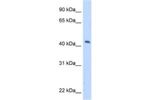 Western Blotting (WB) image for anti-Melanoma Antigen Family A, 1 (Directs Expression of Antigen MZ2-E) (MAGEA1) antibody (ABIN2462943) (MAGEA1 抗体)