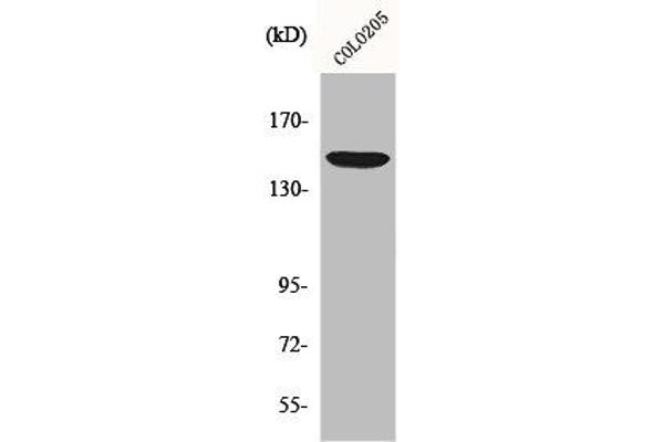 ABCC1 抗体  (Internal Region)