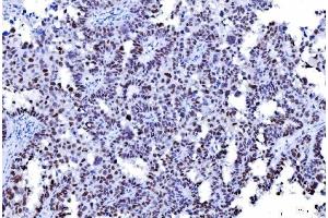IHC analysis of MSH2 using anti-MSH2 antibody (ABIN7601369). (MSH2 抗体  (AA 337-583))