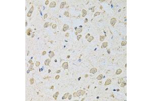 Immunohistochemistry (Paraffin-embedded Sections) (IHC (p)) image for anti-Proteasome (Prosome, Macropain) 26S Subunit, ATPase, 2 (PSMC2) (AA 1-160) antibody (ABIN3015801)