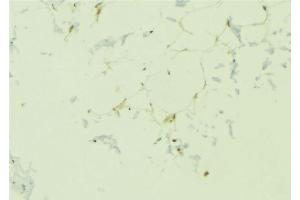 ABIN6276695 at 1/100 staining Human lung tissue by IHC-P. (Adiponectin Receptor 1 抗体  (C-Term))