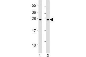 Western blot testing of SOCS1 antibody at 1:2000 dilution.
