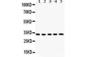 Anti-HSD11B1  antibody, Western blottingAll lanes: All lanes: Anti HSD11B1  at 0. (HSD11B1 抗体  (N-Term))